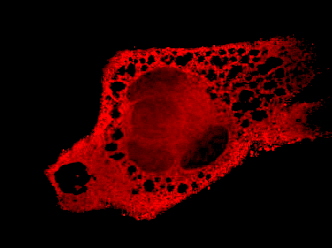 Zellen rfp confocal CSU 01log
